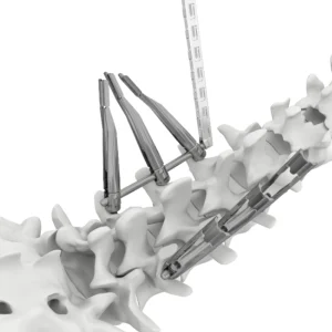 HOBBIT MIS Spine System