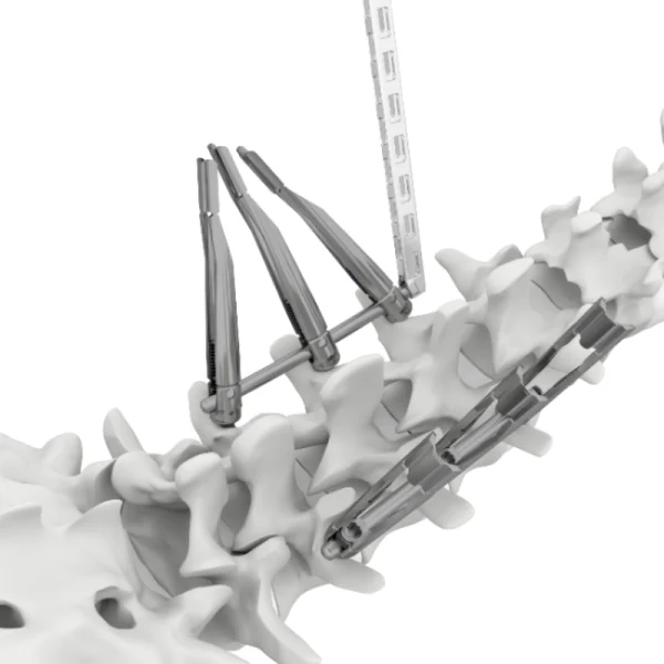 HOBBIT MIS Spine System