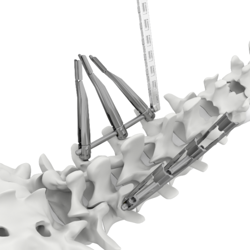 HOBBIT MIS Spine System