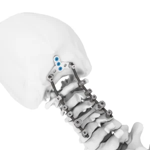 Posterior Cervical