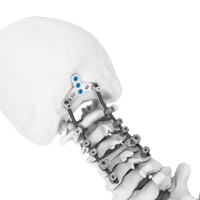 Posterior Cervical