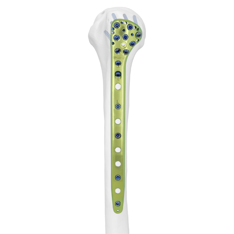 Proximal Humeral Locking Plate III